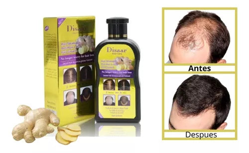 FORTYRAIZ Pack Shampoo Y Serum Anticaida Jengibre